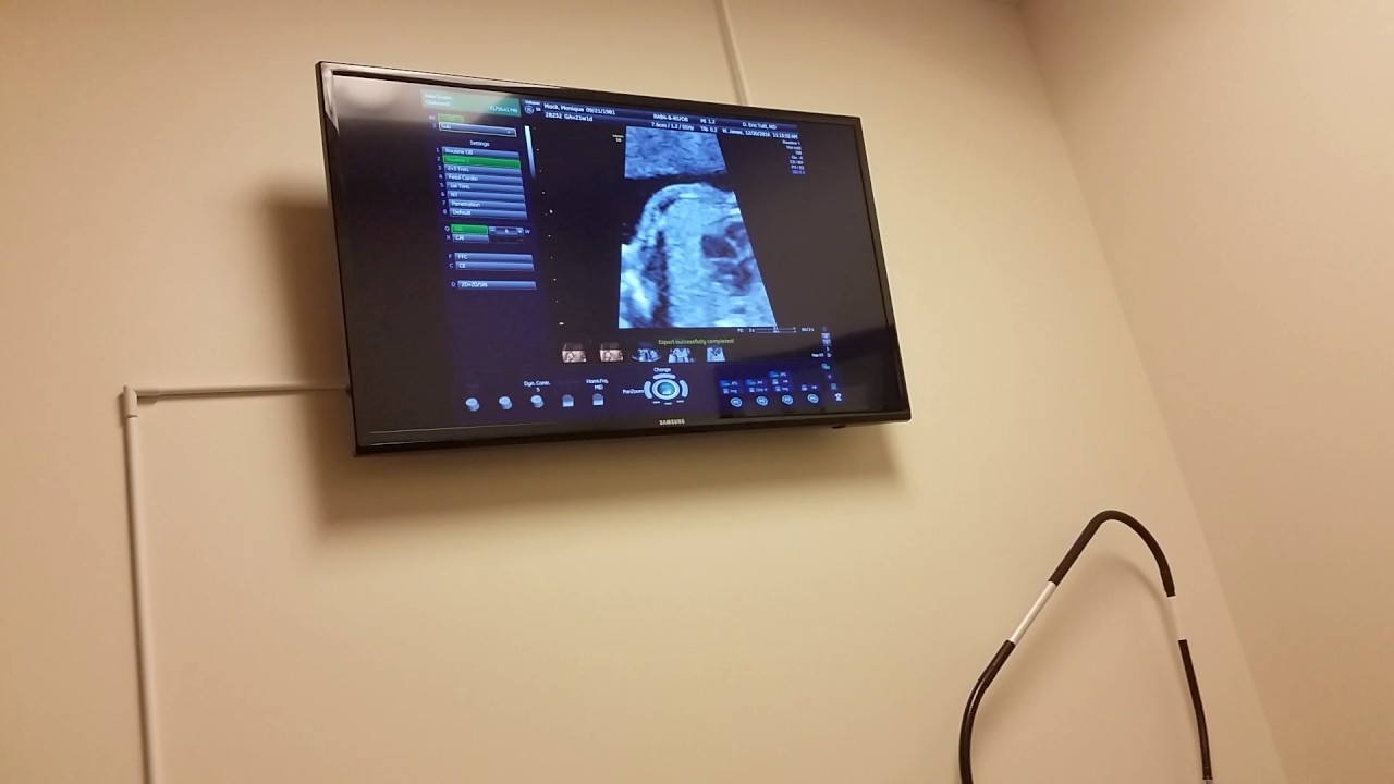 Ultrasound Appointment Baby 6 YouTube