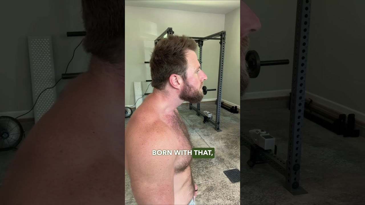 Tongue Tie Could Be Causing Your NECK ISSUES! #shorts