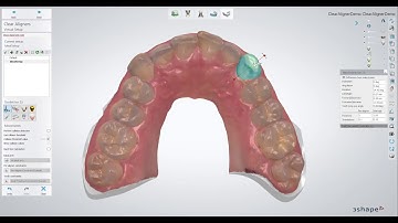 3Shape Clear Aligner Studio Demo Video