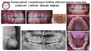 Case report by Dr.Amr Asker