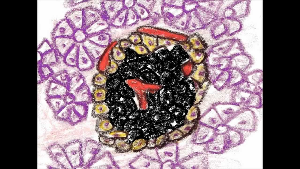 Diabetes Mellitus YouTube