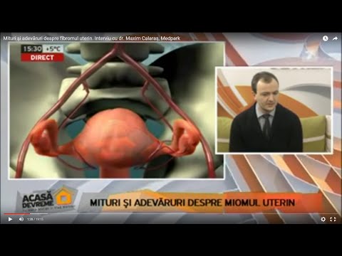 Mituri şi adevăruri despre fibromul uterin. Interviu cu dr. Maxim Calaraș, Medpark