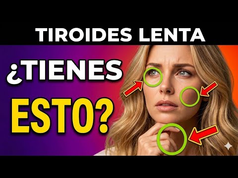 ¡TODOS con TIROIDES LENTA Tienen ESTO en Común! 9 Síntomas PELIGROSOS de HIPOTIROIDISMO