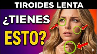 ¡TODOS con TIROIDES LENTA Tienen ESTO en Común! 9 Síntomas PELIGROSOS de HIPOTIROIDISMO