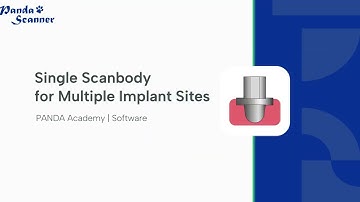 Single Scanbody for multiple Implant Sites