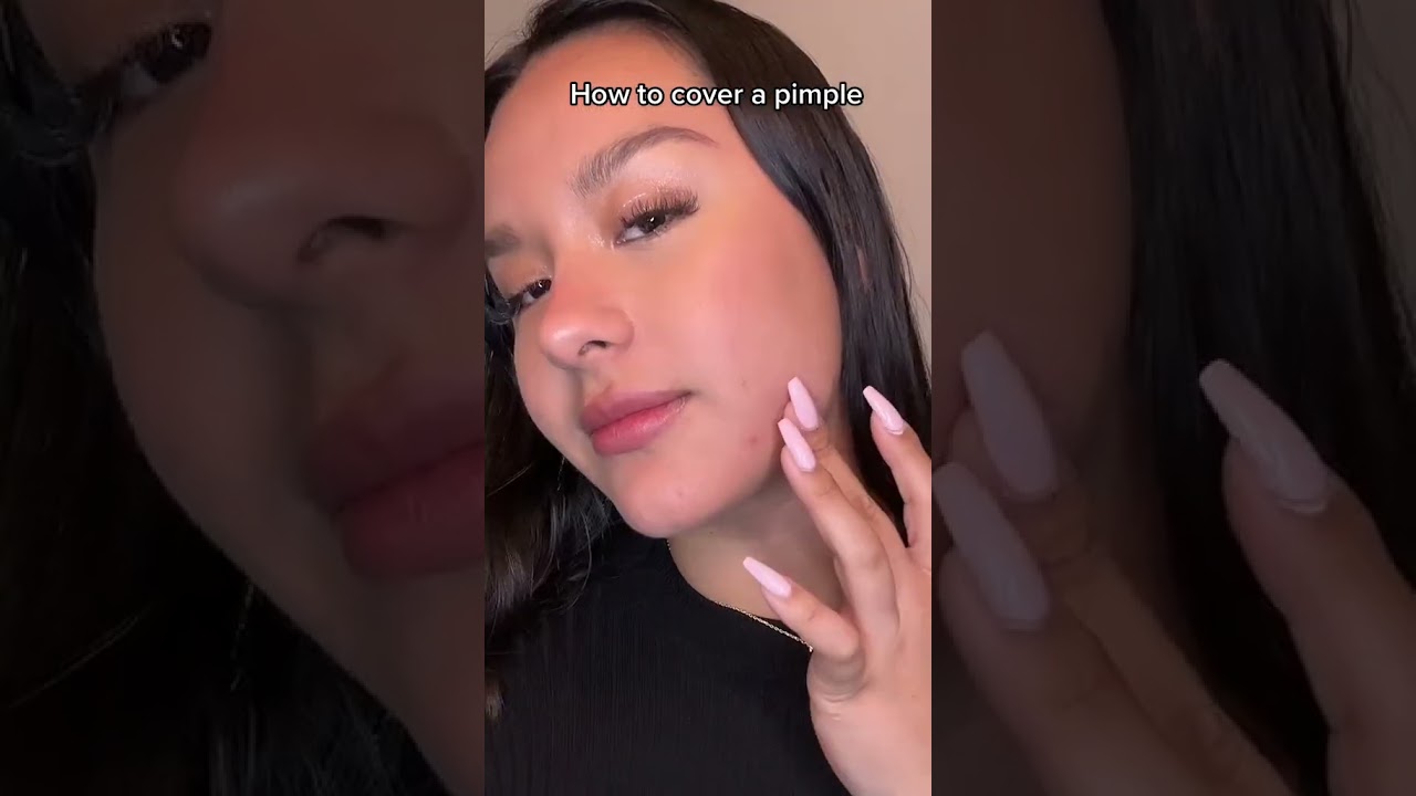 How to cover up a pimple! 