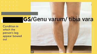 Postural Defects II