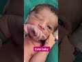 Cute Expression in nicu baby 🥰🥰 #baby #fblifestyle