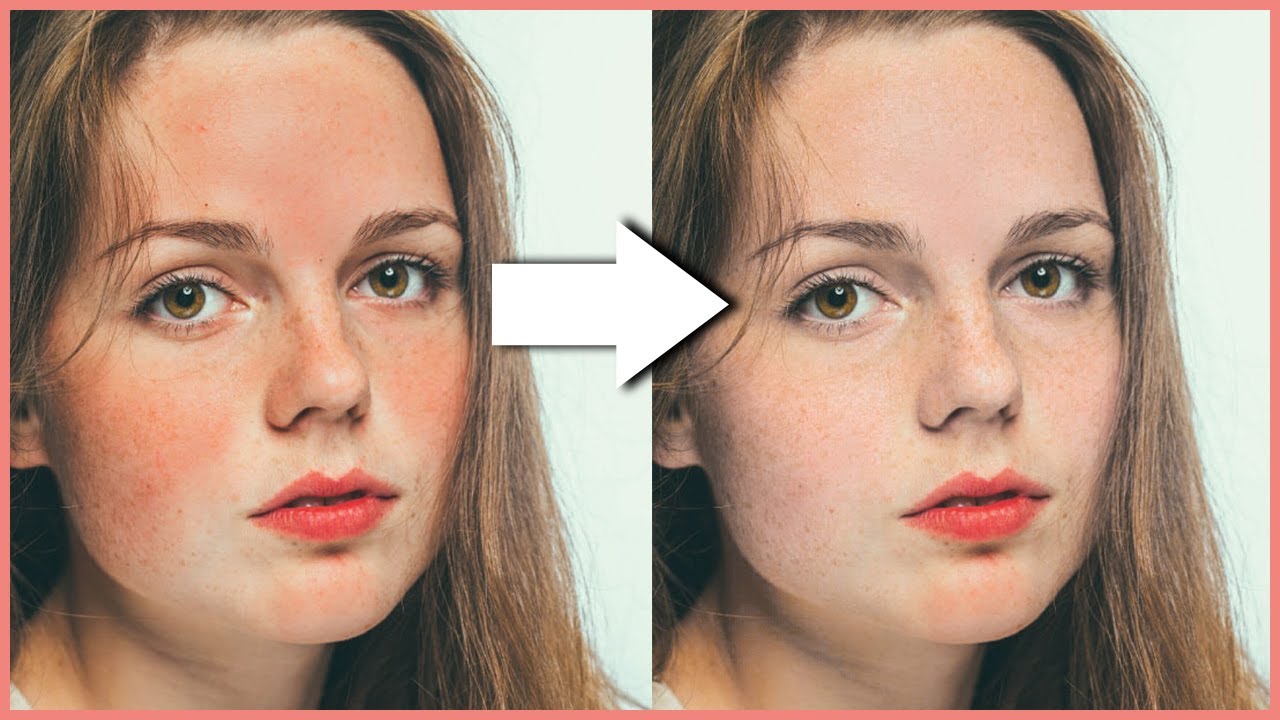 Sida Loogu Saaro Sawirka Red Patches from Skin - YouTube