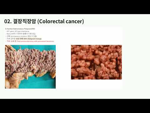 KMLE 강의 시리즈 - Gastroenterology, 16) 대장암