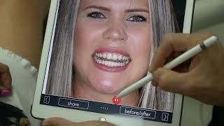 Test Drive Smile