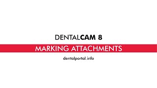 DentalCAM 8 – Marking attachments