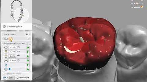 How to fix ERROR [13:0] Minimum thickness failed: 3shape