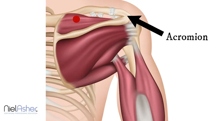Supraspinatus - How To Find Trigger Points (Shoulder Pain) - DayDayNews