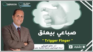 أ.د. حاتم العيشي .Trigger Finger صباعي بيعلق