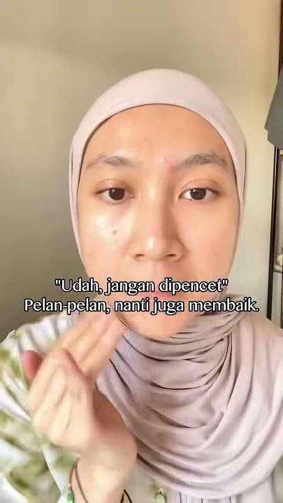 Kenapa kalian lebih suka mencet jerawat dibanding ngerawat jerawat? #acneprone #jerawat