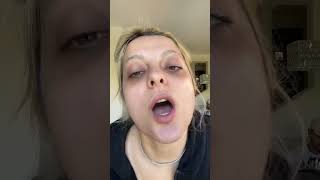 Famous Bebe Rexha sjell transformimin që po pushton rrjetet sociale | Vox News Albania Wealth