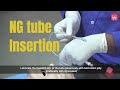 Ryles tube insertion procedure step by step