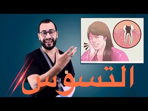 فيديو: ما الذي يجعل السن غير قابل للرعاية؟