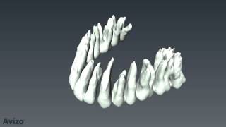 Amazing tooth segmentation video from FEI’s 3D visualization solution (Avizo3D.com)