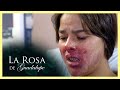 La Rosa de Guadalupe: ¡A Líli le explota un vapeador en la boca! | La sonrisa del corazón