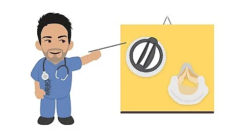 Echo Pearls Introducting prosthetic heart valves