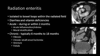 CT MR evaluation of Crohn's disease