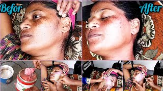 Full Face Waxing Kaise Karen Step By Step|How To Remove Facial Hair Kaise Hataye?|#shineandglow