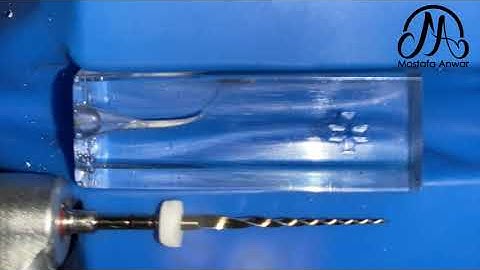 Navigator Evo Rotary System used as Single File Concept for Root Canal Shaping | Educational Video