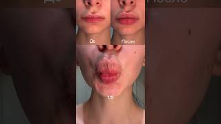 5/5 👄 Упражнения для увеличения губ👄 Сохраняй и повторяй!✨ #увеличениегуб #пухлыегубы #губы УК