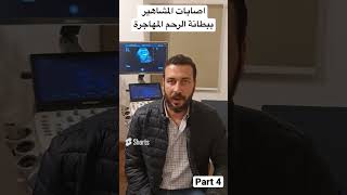 اصابات المشاهير ببطانة الرحم المهاجرة