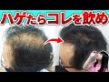 【新発見】発毛のプロが認めた薄毛改善におすすめのとにかく飲んでほしいイチオシの飲みものを紹介します。