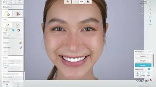 3Shape smile design