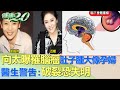 向太 曝罹腦瘤肚子腫大像孕婦 醫生警告:破裂恐失明 健康2.0