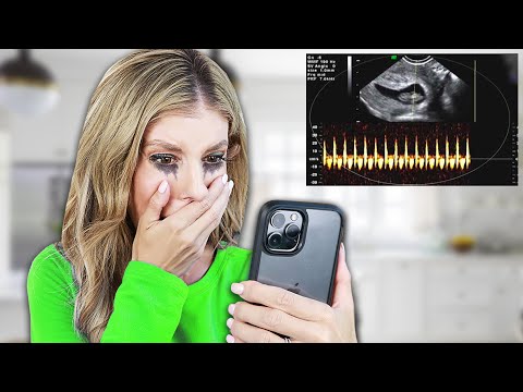 Rebecca Hears Her Baby&rsquo;s Heartbeat for the First Time