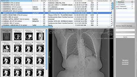 Importing DICOM files form CD and DVD
