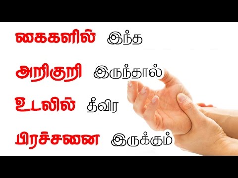 கைகளில் அறிகுறி உடலில் பிரச்சினை-  serious condition you can detect simply looking at your hand.