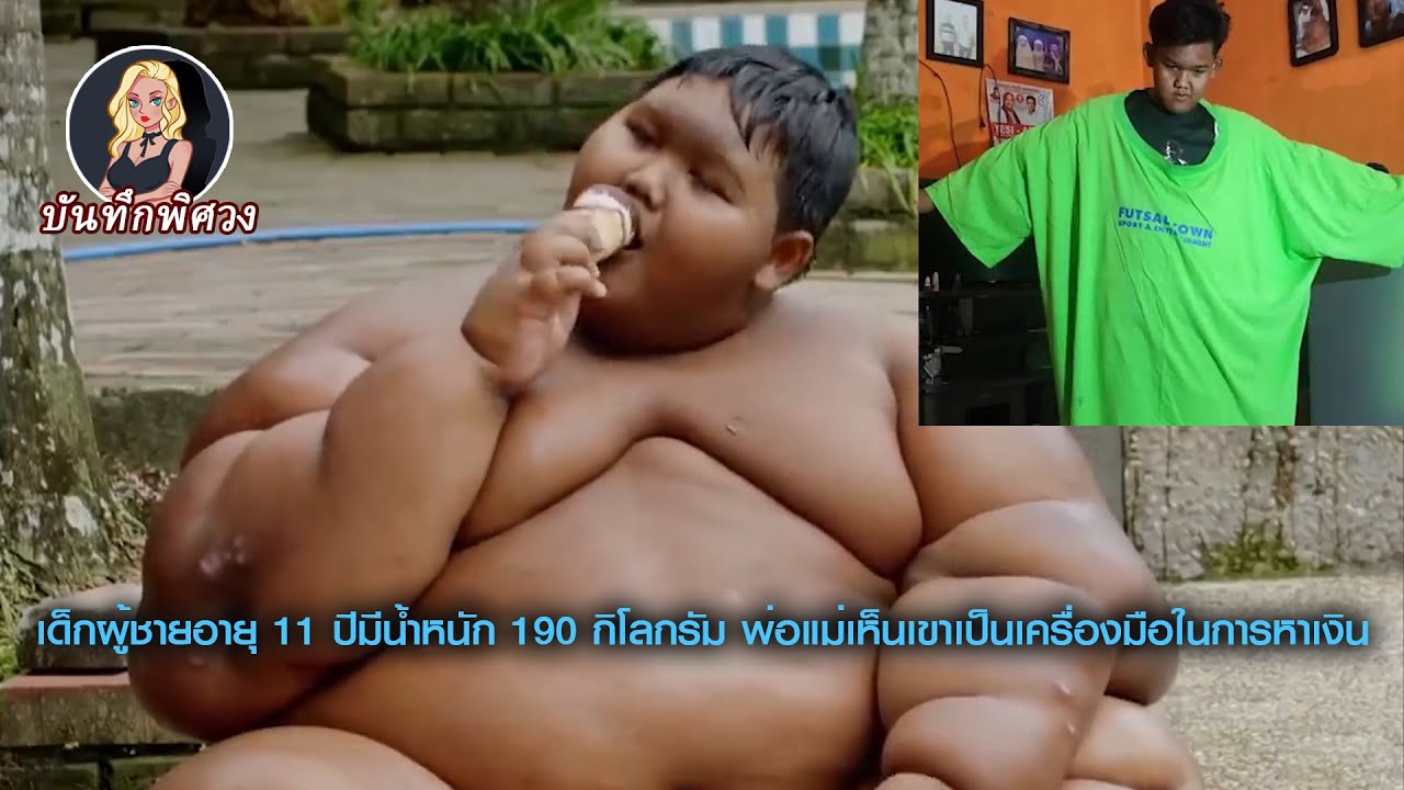 พ่อแม่ภูมิใจมากกับน้ำหนักลูกชาย 190ก.ก. ในวัย11ขวบ หนักที่สุดในอินโดนีเซีย ซึ่งอาจมีอันตรายถึงชีวิต