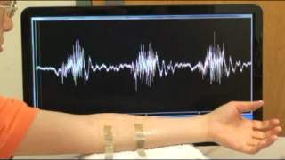 Epidermal Electronics at work