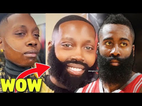 Female Studs in Atlanta  Are Getting Weave Beards To Look Like James Harden...And I'm Happy About It