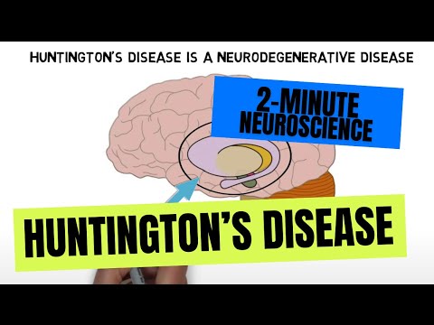 20 Famous People with Huntington's Disease - Discover Walks Blog