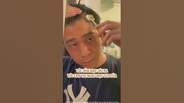 Serum kích thích Mọc Tóc, lấp đầy mảng hói, tóc rụng nhiều - Abera Men