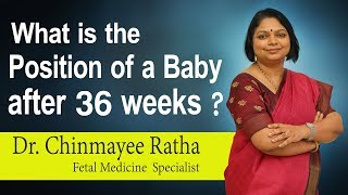 Hi9 | What is the Position of a Baby after 36 weeks? | Dr. Chinmayee Ratha | Fetal  Specialist
