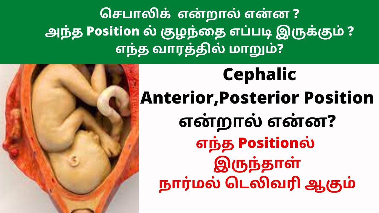 cephalic presentation symptoms in tamil