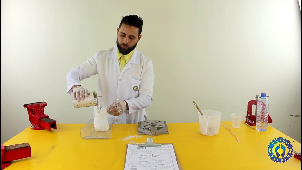 FABRICAÇÃO DE PRÓTESE DE SILICONE PARA AMPUTAÇÃO PARCIAL DE PÉ