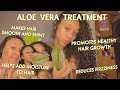 USING ALOE VERA TREATMENT FOR HAIR GROWTH