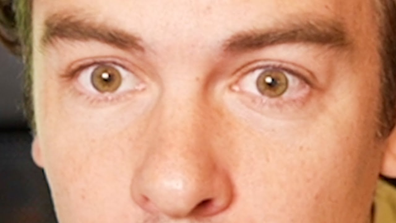 eye surgery gone wrong YouTube