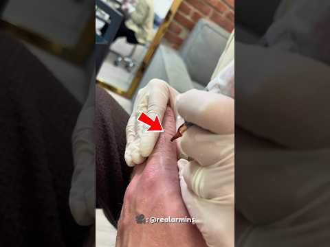 He Tattooed a Ruler on His Finger… Everyone Laughed Until They Realized Why! 🤯 #Shorts