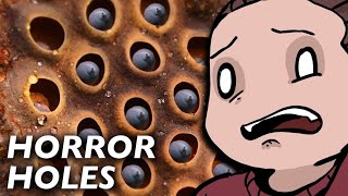 Can You P This Trypophobia Test? No Graphic Images