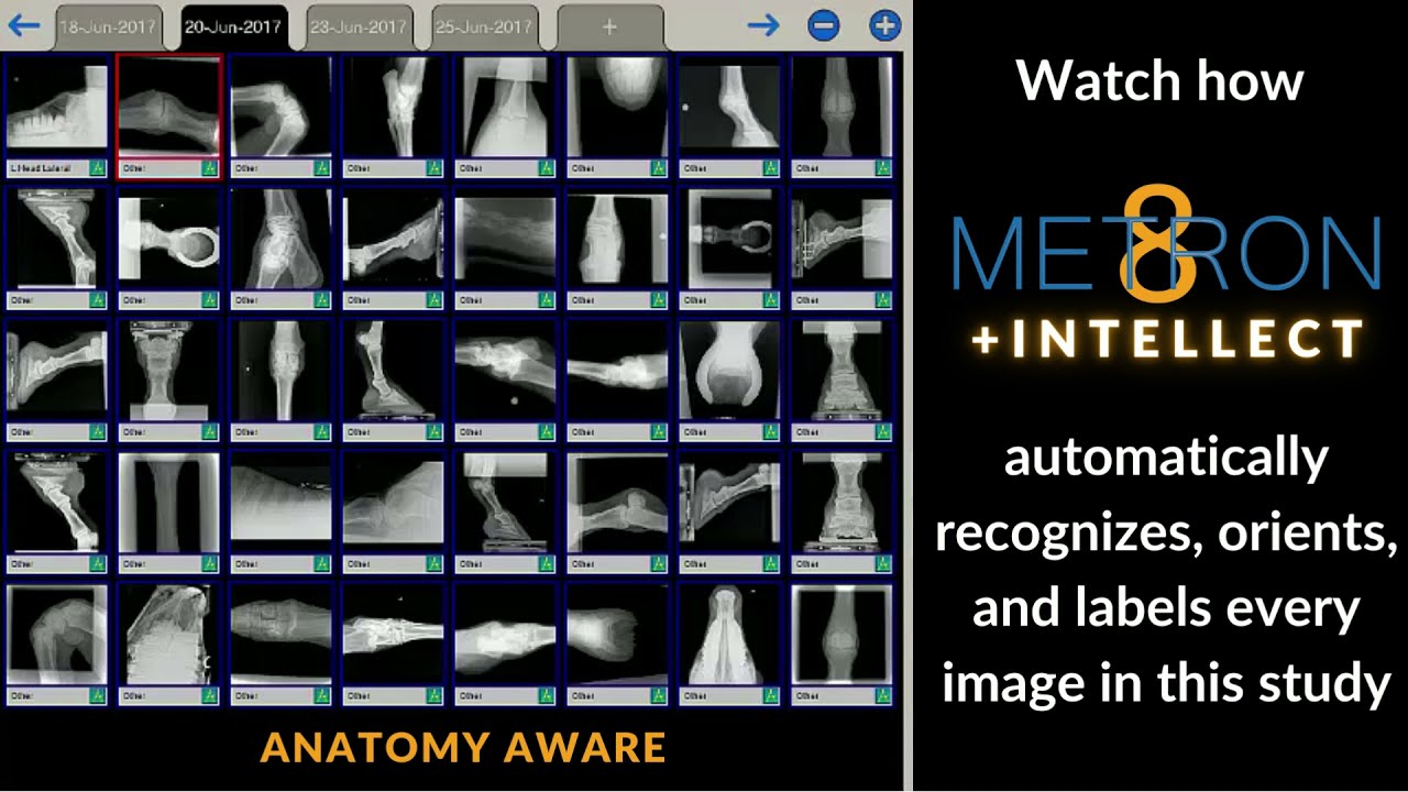 Meton 8 +Intellect - Anatomy Aware